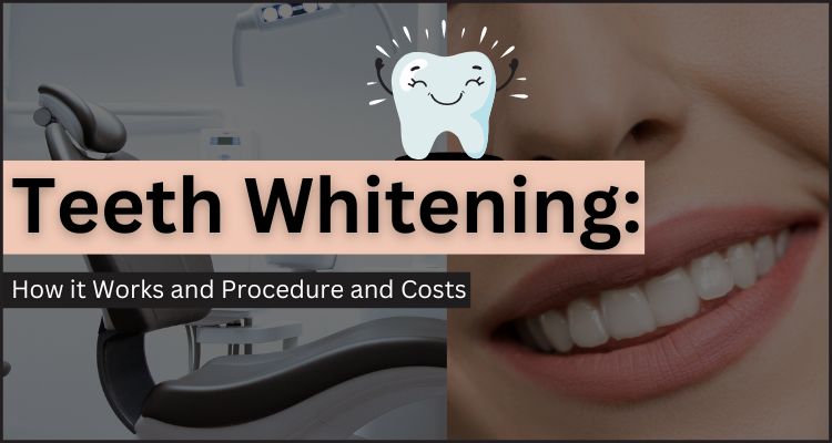 Teeth Whitening How it Works and Procedure and Costs