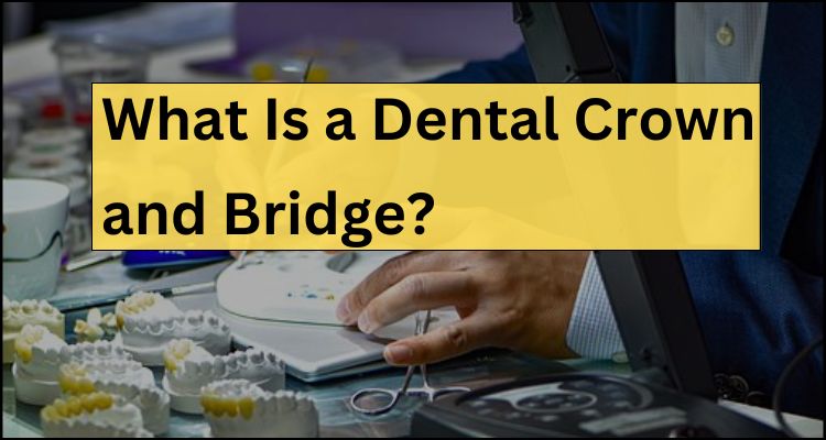 What Is a Dental Crown and Bridge